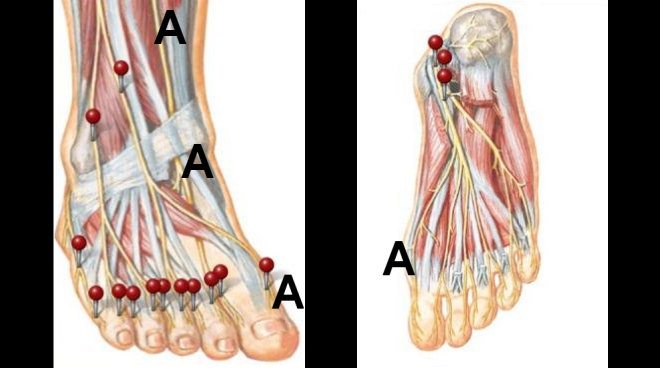 foot diagram by Netter's Anatomy